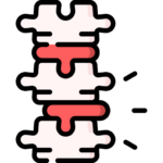 image illustrating mobility of the spine